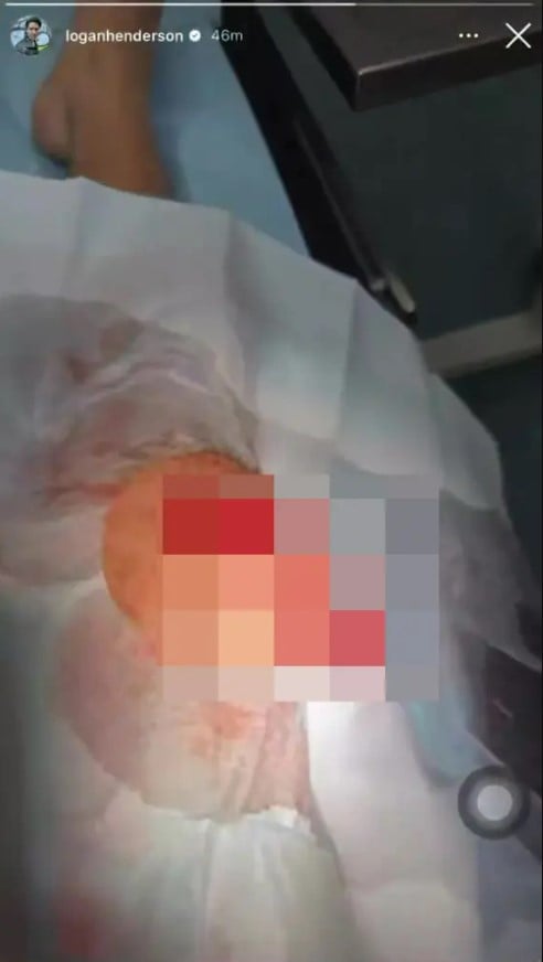 كان يؤدي وصلة غنائية نجم أميركي يتعرض لشق كبير في ركبته على المسرح! (صور)